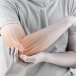 Holding elbow with pain from arthritis