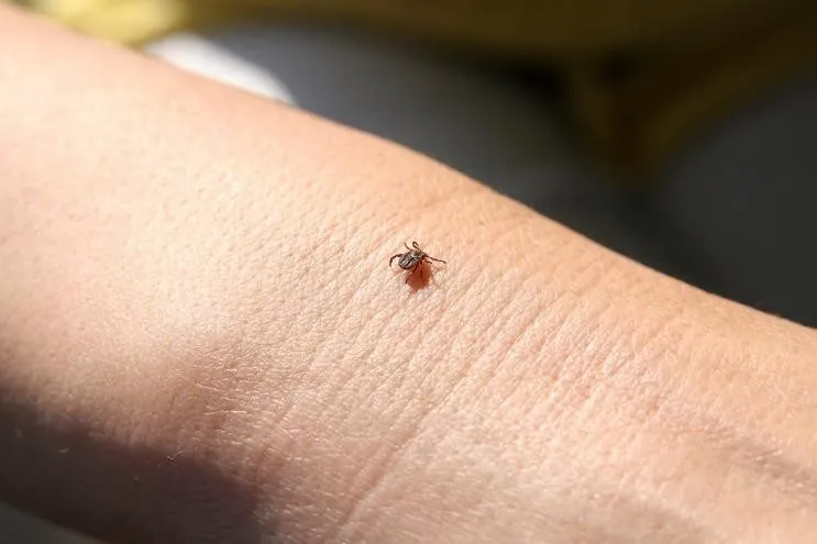 Tick infestation on hand