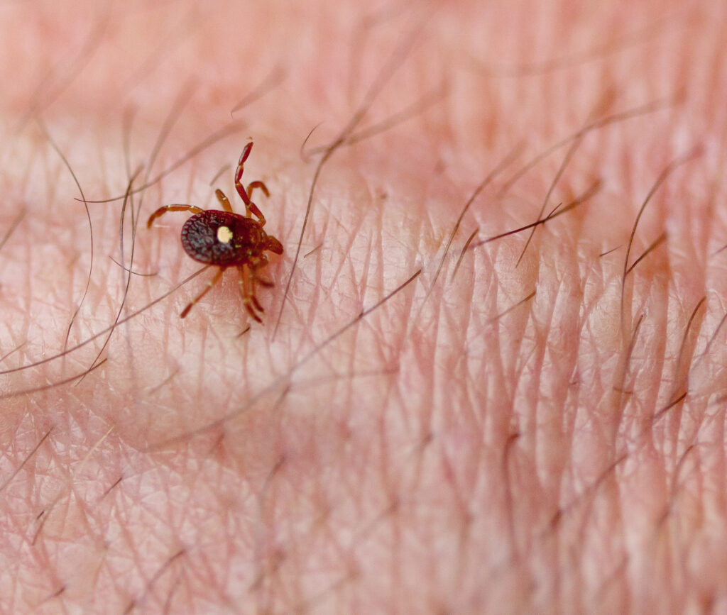 Lone Star Tick (Amblyomma americanum) on human skin